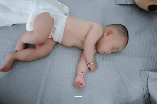泰兴六个月宝宝眼睛散光